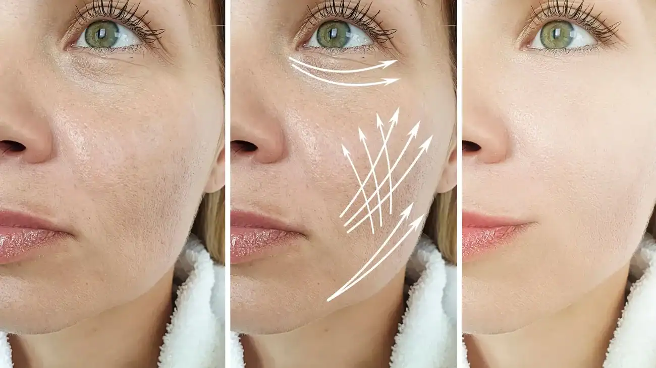 Can One Treatment Really Tackle More Than One Skin Concern Ascot?