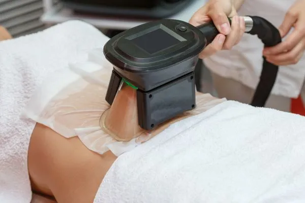 Image of person having fat freezing treatment to help weight gain Ascot