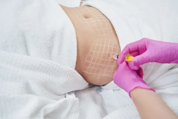 image of fat dissolving injections on love handles to help combat weight gain Ascot