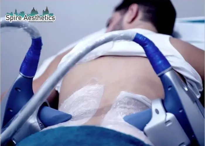 Man having fat freezing treatment done on love handles before a competitions Ascot to create a sculpted look.