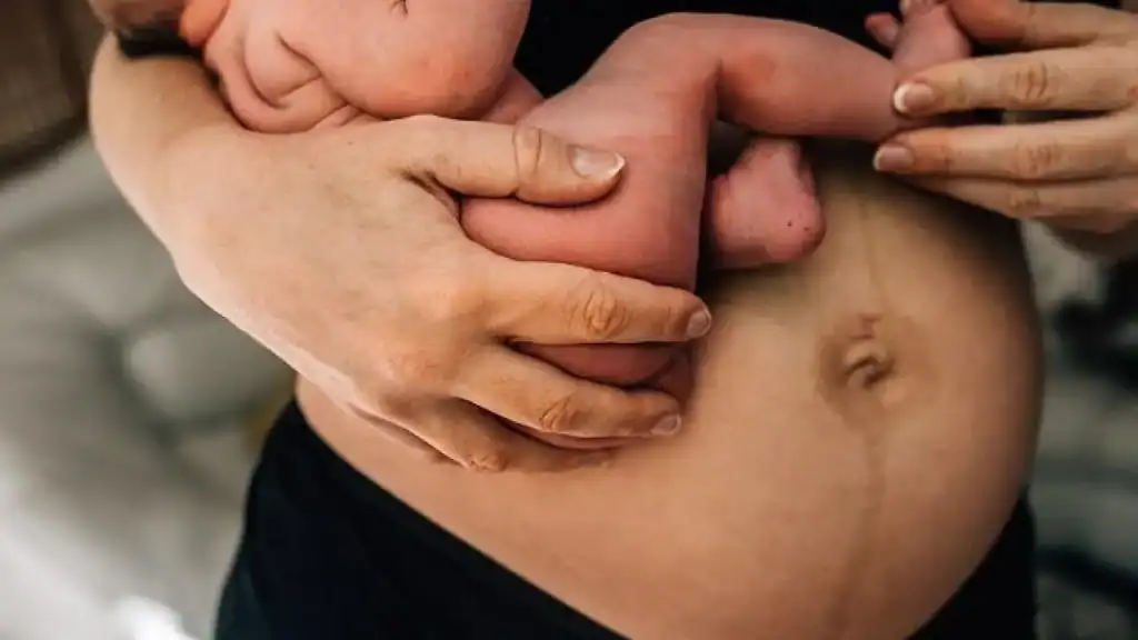 Why Is My Stomach Still Big After Pregnancy Ascot?
