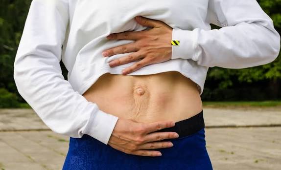 When Could Diastasis Recti Be the Missing Piece of the Puzzle Ascot?